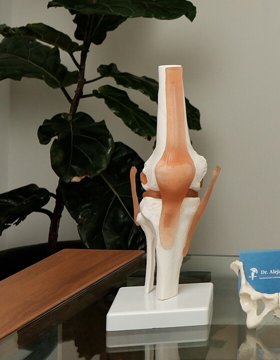 Modelo de prótesis de rodilla – Dr. Alejandro Moya Márquez, Cirujano Ortopédico